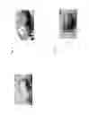 Fig. 03 - METHOD OF CONSTRUCTING ANIMAL HAVING CANCER CELLS TRANSPLANTED THEREINTO