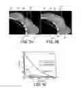 Fig. 06 - Particulate implants and biodegradable fiducial markers