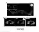 Fig. 07 - PROCESS FOR DELIVERING ENCAPSULATED NEUTRAL BIOIMAGING MOLECULES, COMPLEX, AND PROCESS THEREOF