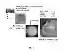 Fig. 02 - COSMETIC COMPOSITION COMPRISING CHRYSOPHANOL AS ACTIVE INGREDIENT FOR SKIN WHITENING