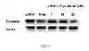 Fig. 10 - COSMETIC COMPOSITION COMPRISING CHRYSOPHANOL AS ACTIVE INGREDIENT FOR SKIN WHITENING