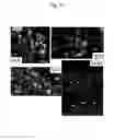 Fig. 13 - Method for producing myocardial sheet from embryonic stem cell