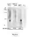 Fig. 29 - Methods for Treating Conditions Associated with MASP-2 Dependent Complement Activation