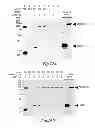 Fig. 34 - Methods for Treating Conditions Associated with MASP-2 Dependent Complement Activation