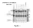 Fig. 62 - Methods for Treating Conditions Associated with MASP-2 Dependent Complement Activation