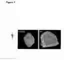 Fig. 08 - Rspondin antibodies as inhibiting factors of angiogenesis and vaculogenesis
