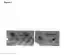 Fig. 09 - Rspondin antibodies as inhibiting factors of angiogenesis and vaculogenesis