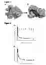 Fig. 03 - Antibodies to TTR and methods of use