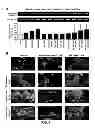 Fig. 02 - Aldosterone induced vascular elastin production