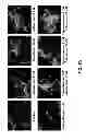 Fig. 06 - Aldosterone induced vascular elastin production