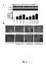 Fig. 07 - Aldosterone induced vascular elastin production
