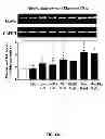 Fig. 08 - Aldosterone induced vascular elastin production