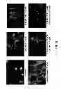 Fig. 12 - Aldosterone induced vascular elastin production