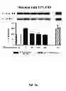 Fig. 13 - Aldosterone induced vascular elastin production