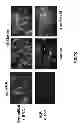 Fig. 17 - Aldosterone induced vascular elastin production