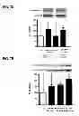 Fig. 18 - Aldosterone induced vascular elastin production