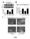 Fig. 19 - Aldosterone induced vascular elastin production
