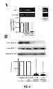 Fig. 20 - Aldosterone induced vascular elastin production