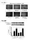 Fig. 22 - Aldosterone induced vascular elastin production