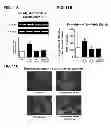 Fig. 24 - Aldosterone induced vascular elastin production