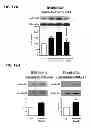 Fig. 25 - Aldosterone induced vascular elastin production