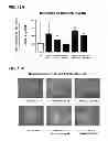 Fig. 27 - Aldosterone induced vascular elastin production