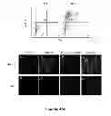 Fig. 07 - METHODS AND  COMPOSITIONS FOR TREATING INFLAMMATORY CONDITIONS