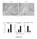 Fig. 13 - METHODS AND  COMPOSITIONS FOR TREATING INFLAMMATORY CONDITIONS