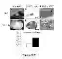 Fig. 15 - METHODS AND  COMPOSITIONS FOR TREATING INFLAMMATORY CONDITIONS