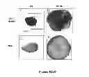 Fig. 22 - METHODS AND  COMPOSITIONS FOR TREATING INFLAMMATORY CONDITIONS
