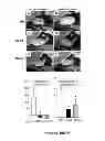 Fig. 25 - METHODS AND  COMPOSITIONS FOR TREATING INFLAMMATORY CONDITIONS