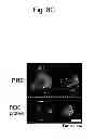 Fig. 12 - PHARMACEUTICAL COMPOSITION FOR TREATING OR PREVENTING CANCER BY INDUCING DENDRITIC CELL-LIKE DIFFERENTIATION FROM MONOCYTES TO IMPROVE ANTICANCER IMMUNE ACTIVITY