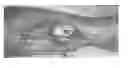 Fig. 01 - Methods for Improving Fracture Healing and Bone Formation
