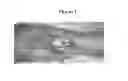 Fig. 02 - Methods for Improving Fracture Healing and Bone Formation