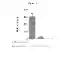Fig. 14 - Methods for Improving Fracture Healing and Bone Formation