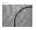 Fig. 02 - DRUG DELIVERY SYSTEM