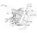 Fig. 01 - METHOD AND SYSTEM FOR TREATING DEPRESSION OR EPILEPSY