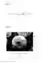 Fig. 02 - Enhanced Carriers For The Delivery of Microparticles To Bodily Tissues And Fluids