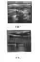 Fig. 02 - Herbal polypharmaceutical for preventing and treating atherosclerosis