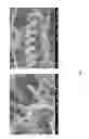 Fig. 10 - Method for fabricating coiled nano carbon material, coiled nano carbon layered substrate and coiled nano carbon material thereof