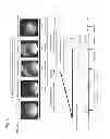 Fig. 06 - Method for Measuring Glycoprotein, Method for Examining Liver Desease, Reagent for Quantitative Determination of Glycoprotein and Glycan-Marker Glycoprotein as an Index for Clinical Conditions of Liver Disease