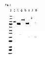 Fig. 07 - Flavin-bound glucose dehydrogenases, a method for producing a flavin-bound glucose dehydrogenase, and yeast transformant used for the same