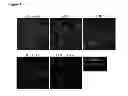 Fig. 04 - METHODS FOR THE IDENTIFICATION OF AGENTS THAT INHIBIT MESENCHYMAL-LIKE TUMOR CELLS OR THEIR FORMATION