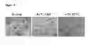 Fig. 05 - METHODS FOR THE IDENTIFICATION OF AGENTS THAT INHIBIT MESENCHYMAL-LIKE TUMOR CELLS OR THEIR FORMATION