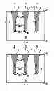 Fig. 03 - Isolation structure profile for gap filing
