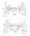 Fig. 04 - Ambulatory toy