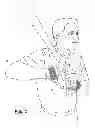 Fig. 03 - Cuff-based athletic training device