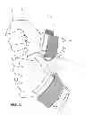 Fig. 04 - Cuff-based athletic training device