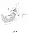 Fig. 05 - Cuff-based athletic training device