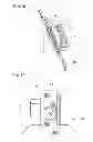 Fig. 12 - Hydraulic auto-tensioner
